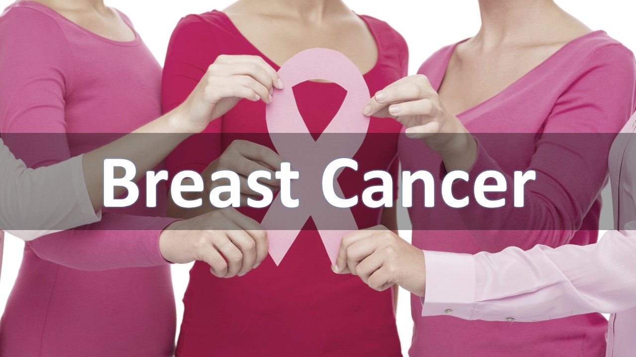 Breast Cancer